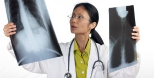 Zapalenie płuc może być powikłaniem po niewyleczonej grypie